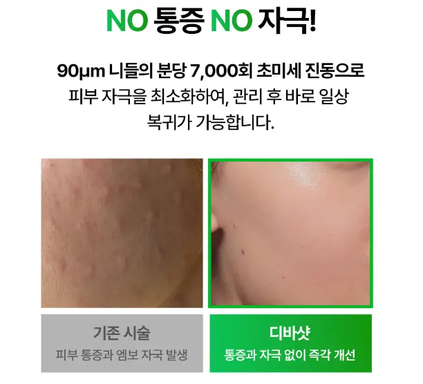 뷰드 디바샷 내돈내산 후기, 효과, 가격, 사용법  총정리