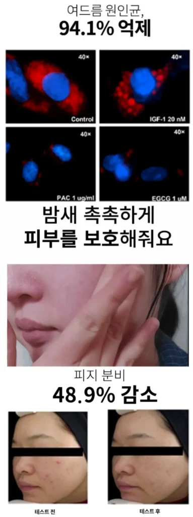 포에이엠 수면크림 내돈내산 후기, 효과, 부작용, 가격 총정리