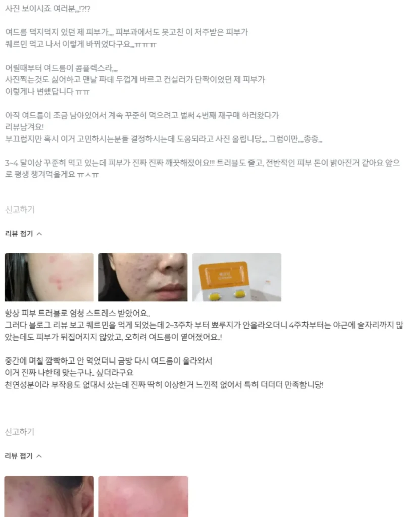 마이디데이 퀘르민 후기