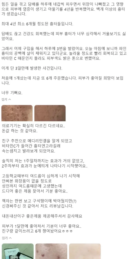 메디리턴겔 후기