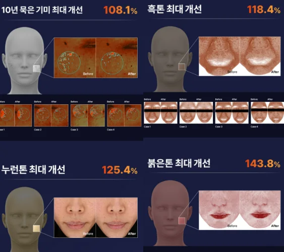 오쏘타민 비타민 앰플 효과