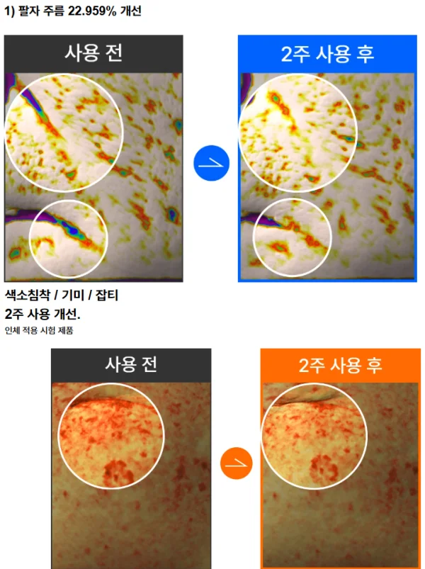 미라클 시드니크림 효과