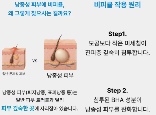 비피큘크림 효과, 성분